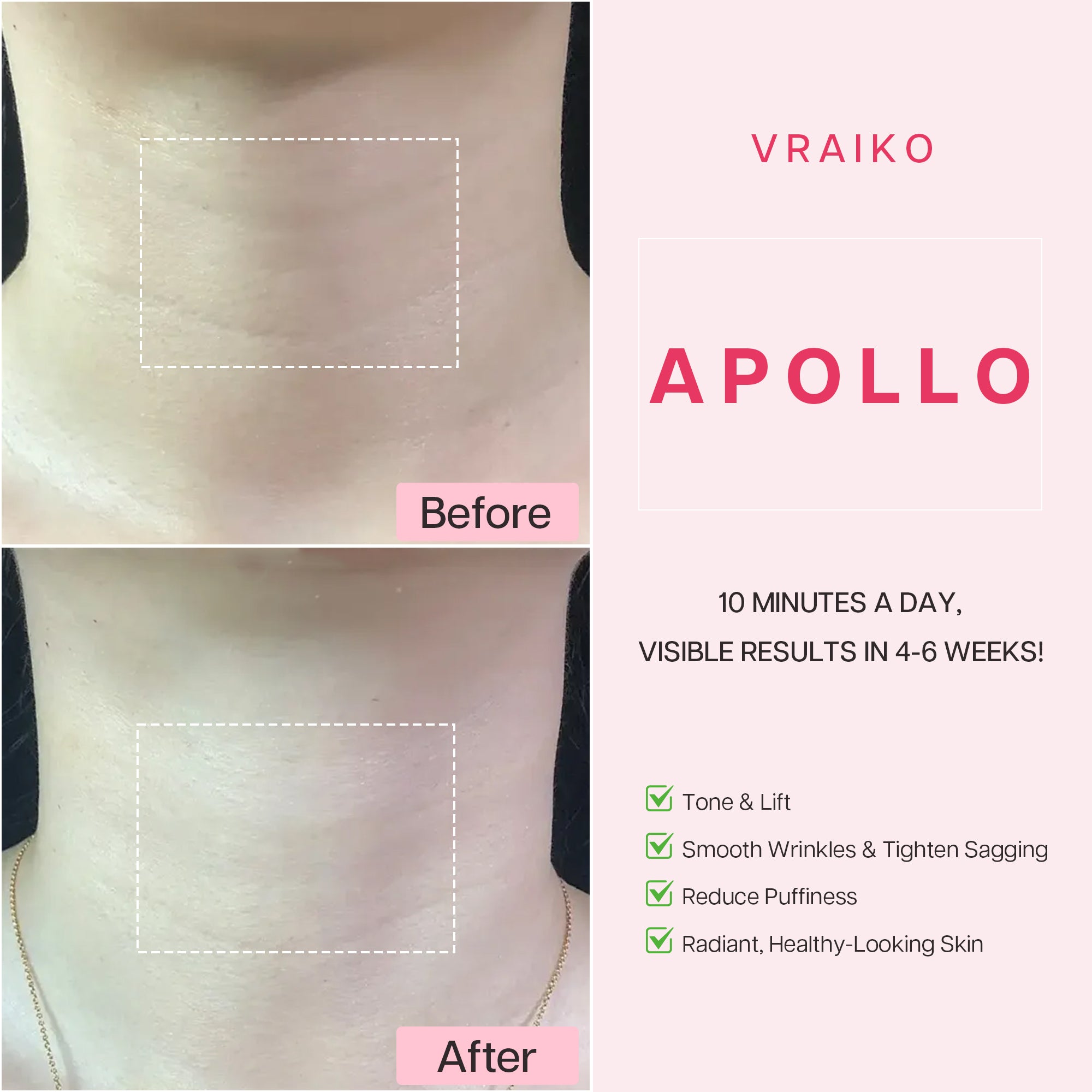 VRAIKO APOLLO Neck Lifting Massager